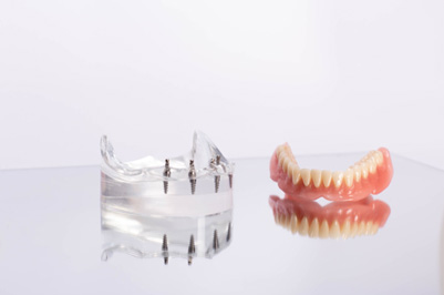 Clear base with implants next to lower arch of dentures on reflective white surface