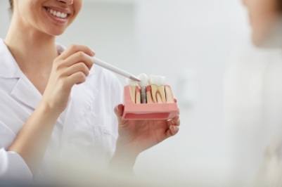 Dentist explaining the four step dental implant process