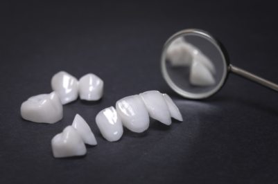 Porcelain veneers options