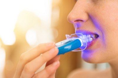 Dental patient receiving teeth whitening treatment