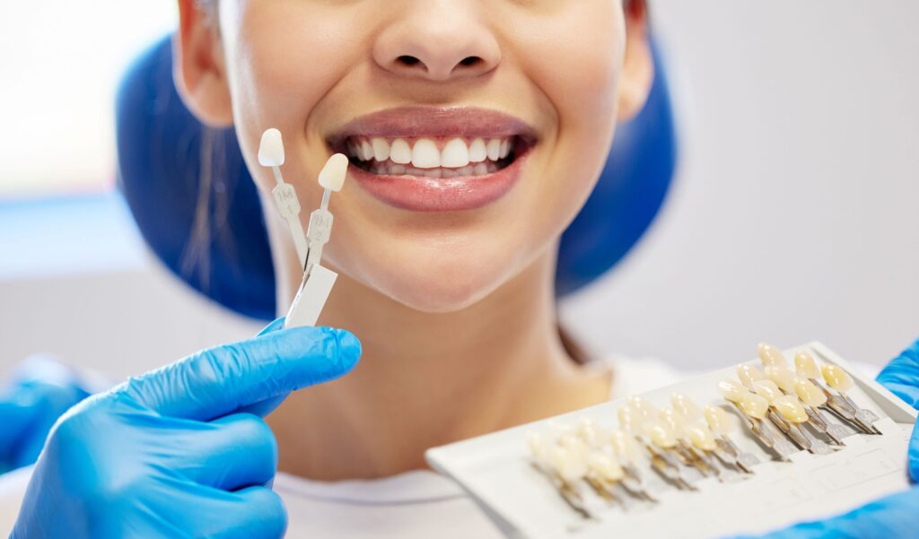 Nose-to-neck view of woman smiling with shade guide held to teeth