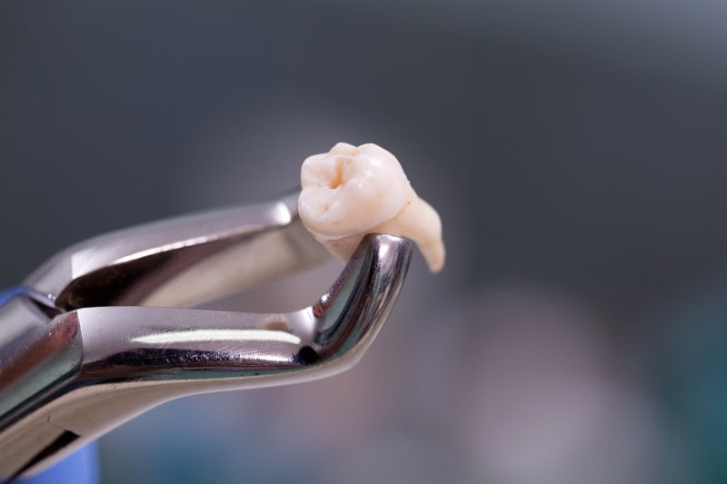 Tooth being extracted