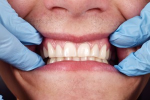 gum disease treatment